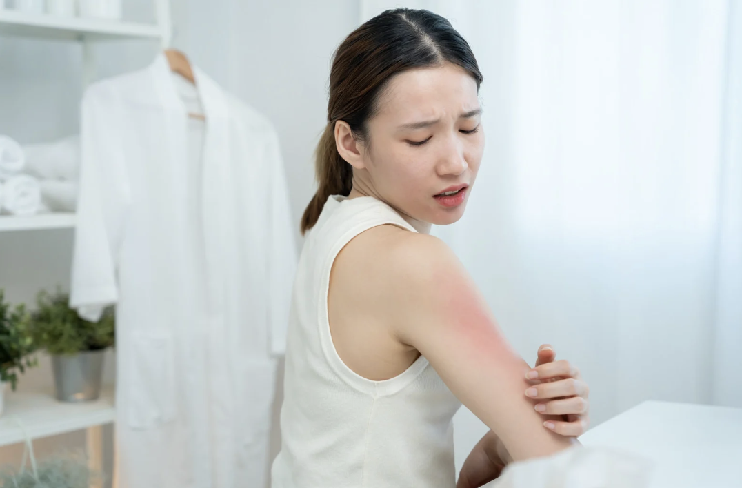 帯状疱疹 イメージ