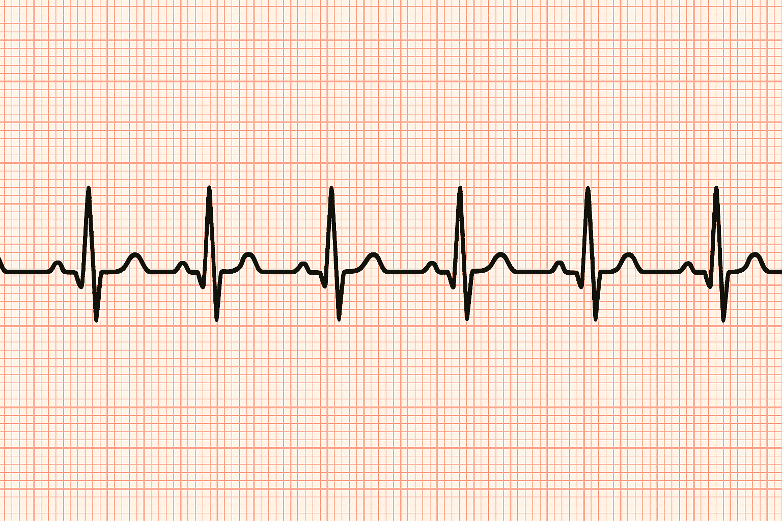 健康診断で行う心電図