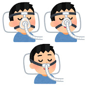 ３種類のCPAP
